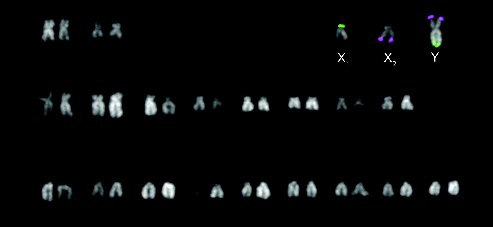 Chromosomes